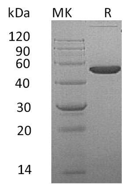 Mouse Ephrin-A4/EFNA4 Recombinant Protein (RPES0495)