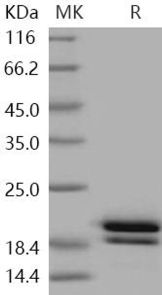 Human REG1B/PSPS2 Recombinant Protein (RPES0501)