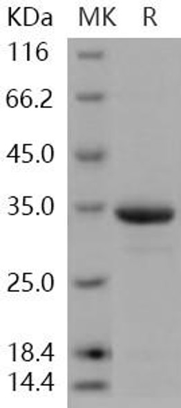 Human HIF alpha/HIF1A Recombinant Protein (RPES0507)