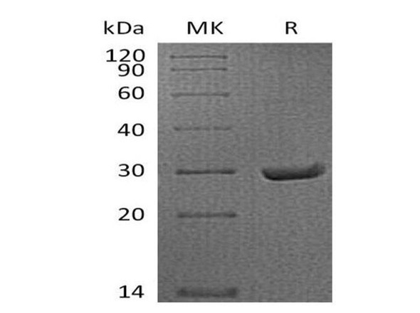 Mouse APCS/SAP Recombinant Protein (RPES0516)