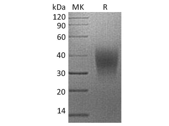 Human B7-H5/Gi24/VSIR Recombinant Protein (RPES0537)