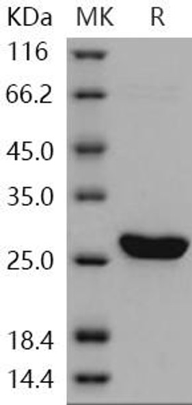 Human UCHL3/UCH-L3 Recombinant Protein (RPES0540)