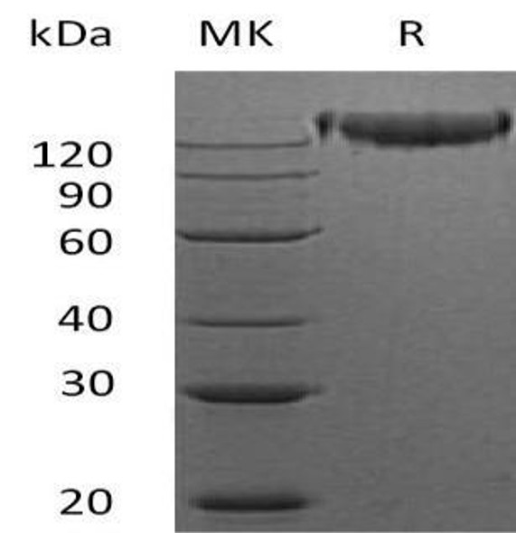 Mouse Semaphorin-4D/SEMA4D Recombinant Protein (RPES0544)