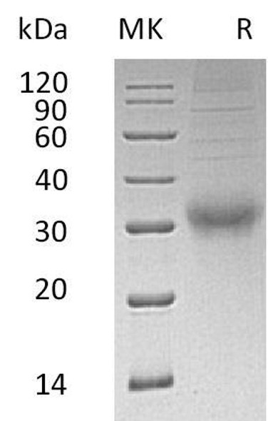 Human CGB3 Recombinant Protein (RPES0566)