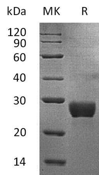 Human NKG2DL/ULBP Recombinant Protein (RPES0568)