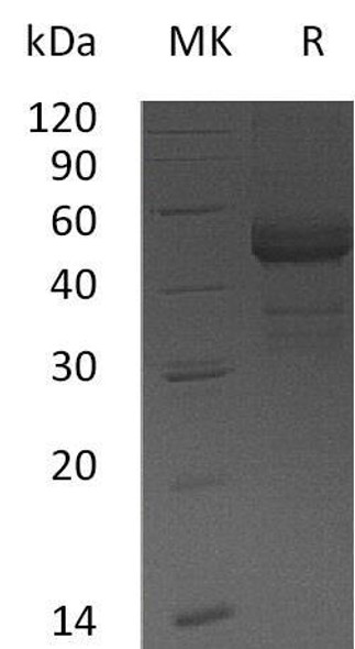 Human TDGF1 Recombinant Protein (RPES0569)
