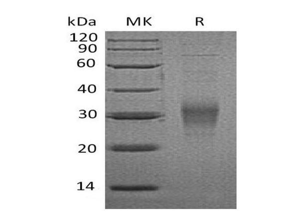 Mouse CD16-2/FCGR4 Recombinant Protein (RPES0592)