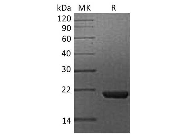 Human Cyclophilin B/PPIB Recombinant Protein (RPES0593)