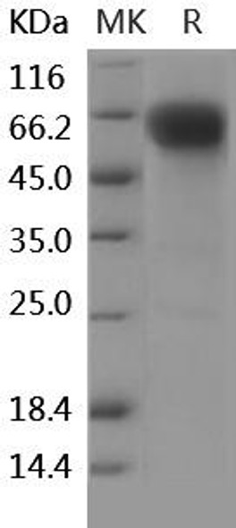 Human CD27/TNFRSF7 Recombinant Protein (RPES0603)