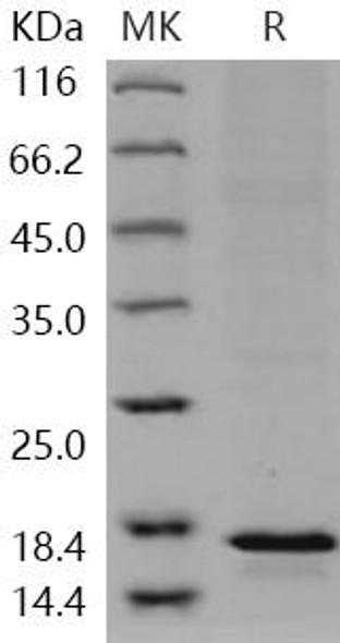 Human LTC4S/LTC4 synthase Recombinant Protein (RPES0616)