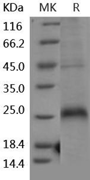 Human CD27/TNFRSF7 Recombinant Protein (RPES0623)