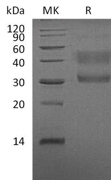 Human HGFR/c-MET Recombinant Protein (RPES0625)