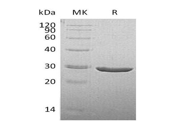 Human TPK1 Recombinant Protein (RPES0627)