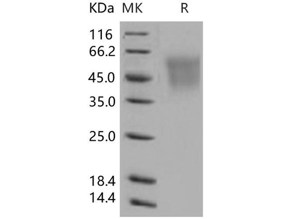Human CEACAM6/CD66c Recombinant Protein (RPES0657)