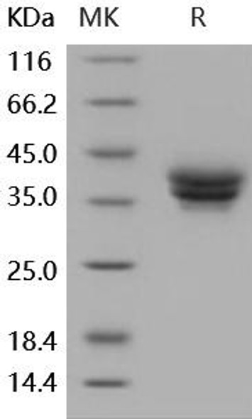 Human ESAM Recombinant Protein (RPES0658)