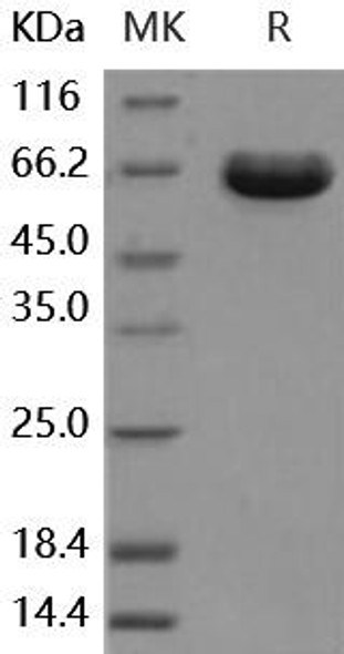 Human ESAM Recombinant Protein (RPES0676)