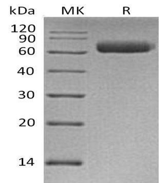 Human NgR3/RTN4RL1 Recombinant Protein (RPES0683)