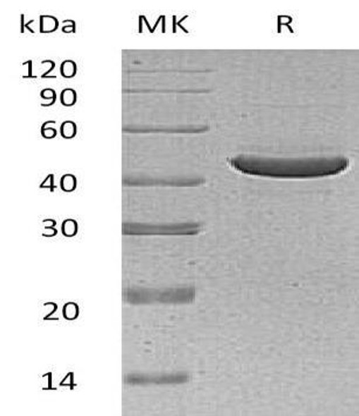 Human SerpinB3/SCCA1 Recombinant Protein (RPES0726)