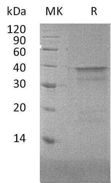 Human NFYA Recombinant Protein (RPES0735)
