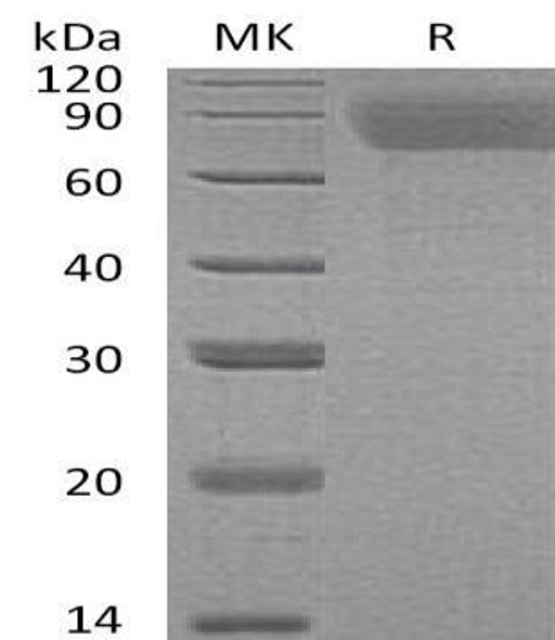 Human Thrombopoietin/TPO Recombinant Protein (RPES0736)