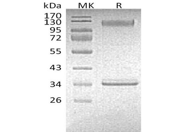 Mouse P-selectin/CD62P Recombinant Protein (RPES0742)