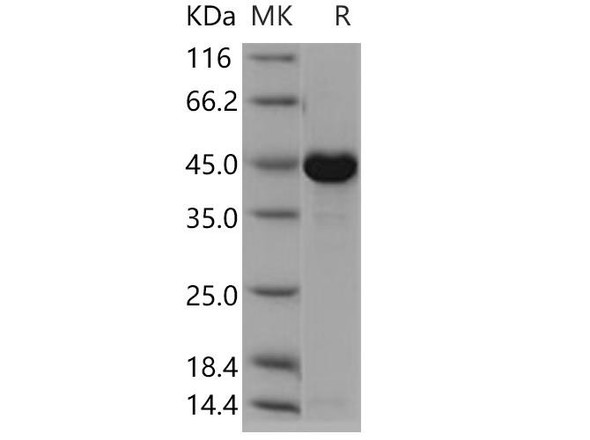 Human CKMT1A Recombinant Protein (RPES0743)