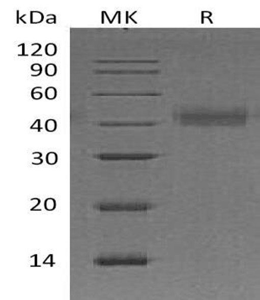 Human Tissue Factor/CD142 Recombinant Protein (RPES0751)