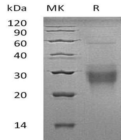 Human NFYA Recombinant Protein (RPES0753)