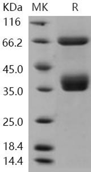 Human CD136/MST1R Recombinant Protein (RPES0780)