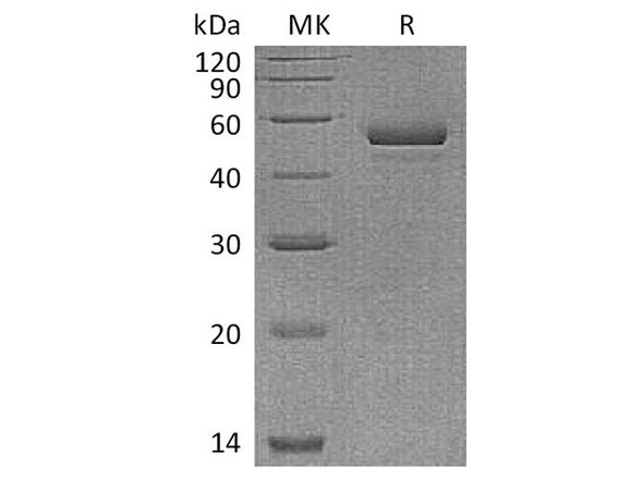 Human NPTX1 Recombinant Protein (RPES0794)