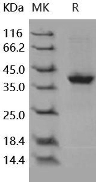 Human S100A2 Recombinant Protein (RPES0800)