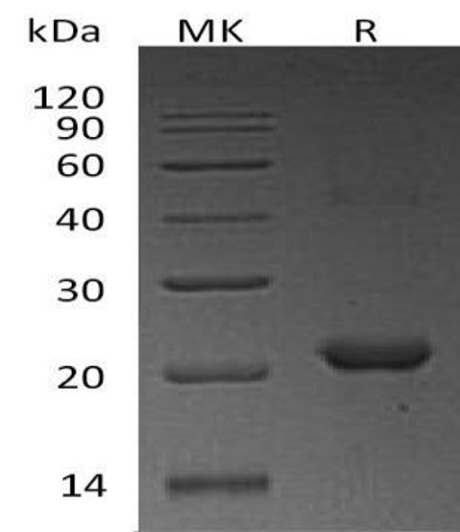Human NHP2/NOLA2 Recombinant Protein (RPES0807)
