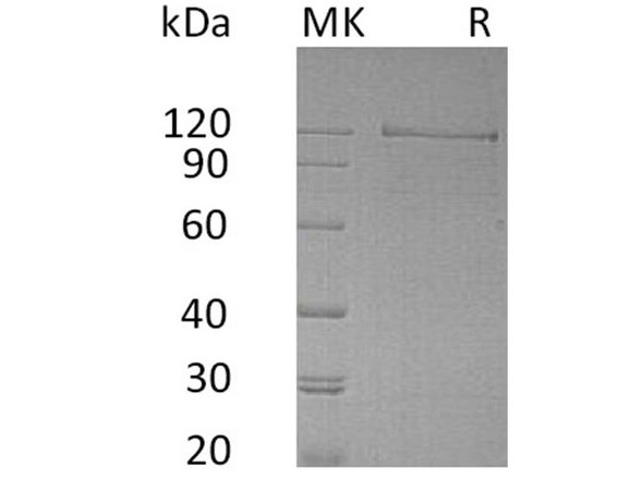 Human NRCAM Recombinant Protein (RPES0813)