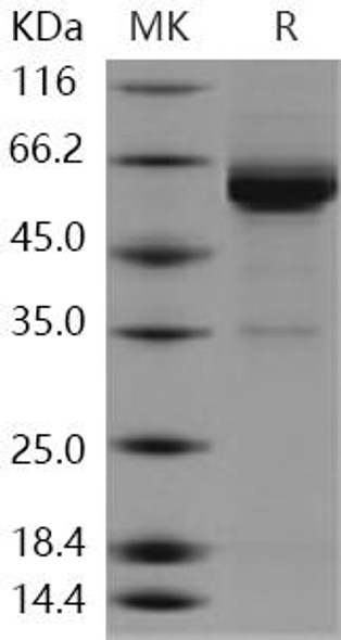 Human IL17RC Recombinant Protein (RPES0822)