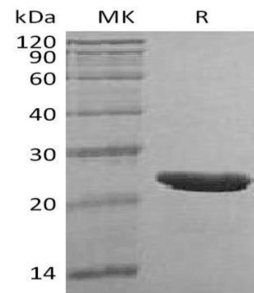 Human TMPO Recombinant Protein (RPES0827)