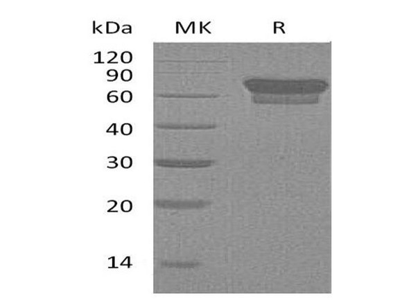 Mouse PD/PDCD1 Recombinant Protein (RPES0833)