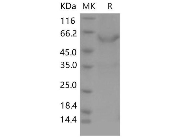 Mouse Meteorin/METRN Recombinant Protein (RPES0839)