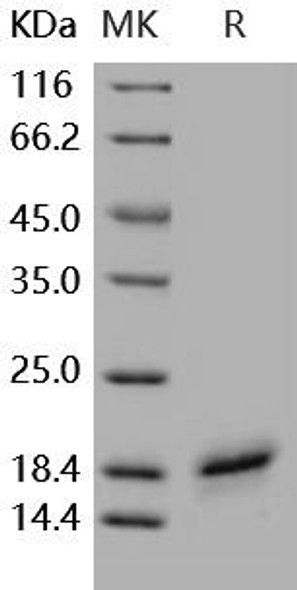 Human CD40L/TNFSF5 Recombinant Protein (RPES0859)