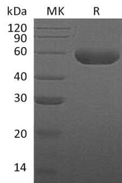 Human Hyaluronidase/HYAL1 Recombinant Protein (RPES0861)