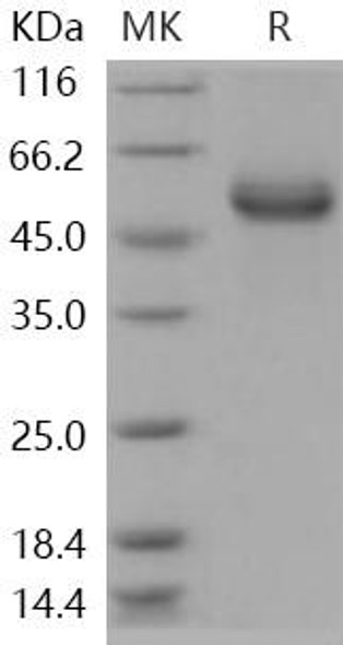 Human HAI/SPINT1 Recombinant Protein (RPES0877)