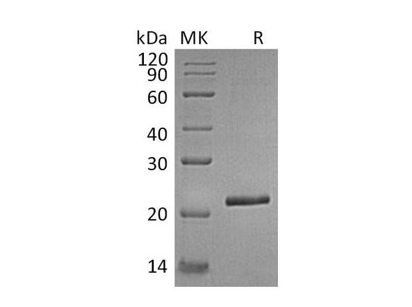 Human TIMP-4/TIMP4 Recombinant Protein (RPES0882)