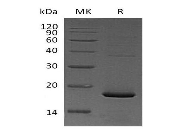 Pleiotrophin/PTN/HB-GAM Recombinant Protein (RPES0888)