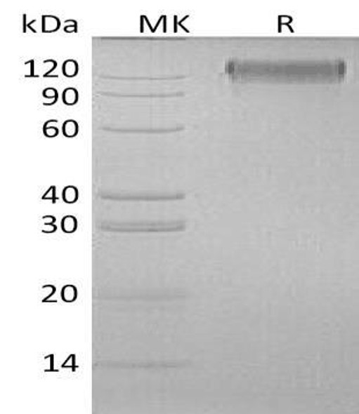 Human OSMR/IL31RB Recombinant Protein (RPES0899)