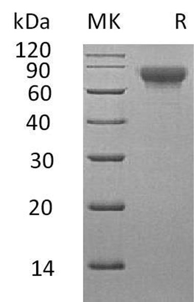 Human SLAMF3/CD229 Recombinant Protein (RPES0918)