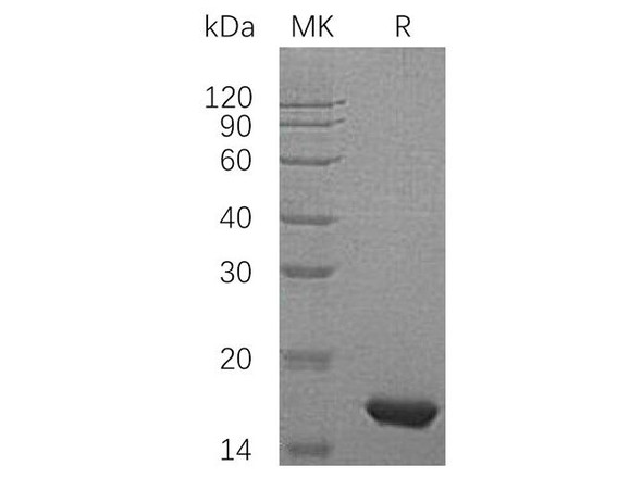 Human PMP2/FABP8 Recombinant Protein (RPES0923)
