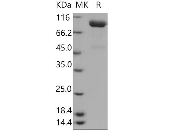 Human SLITRK4 Recombinant Protein (RPES0926)