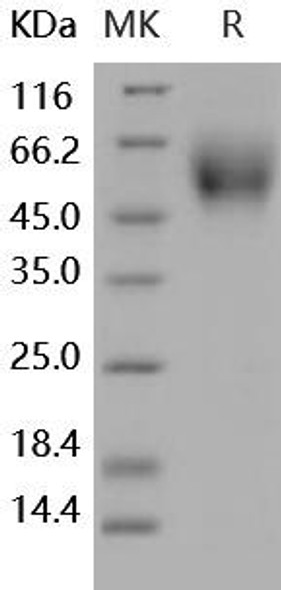 Human DR6/TNFRSF21 Recombinant Protein (RPES0928)