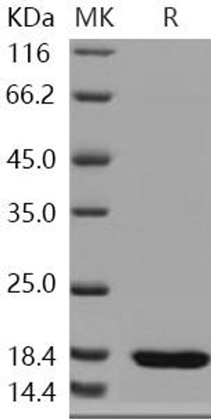 Human SETD8/PR-Set7 Recombinant Protein (RPES0931)