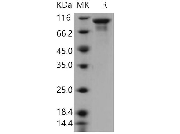 Human STK16/PKL12/MPSK Recombinant Protein (RPES0943)