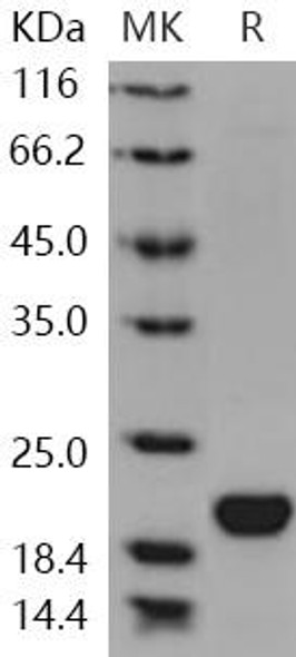 Human LCN1/VEGP/Lipocalin Recombinant Protein (RPES0945)